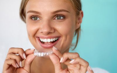 How At Home Whitening Kits Stack Up Against Treatments at Your Dentist’s Office